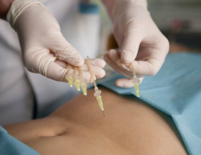 Озонотерапия - Санаторий «Юность» Беларусь